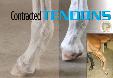 Contracted Tendons Article
